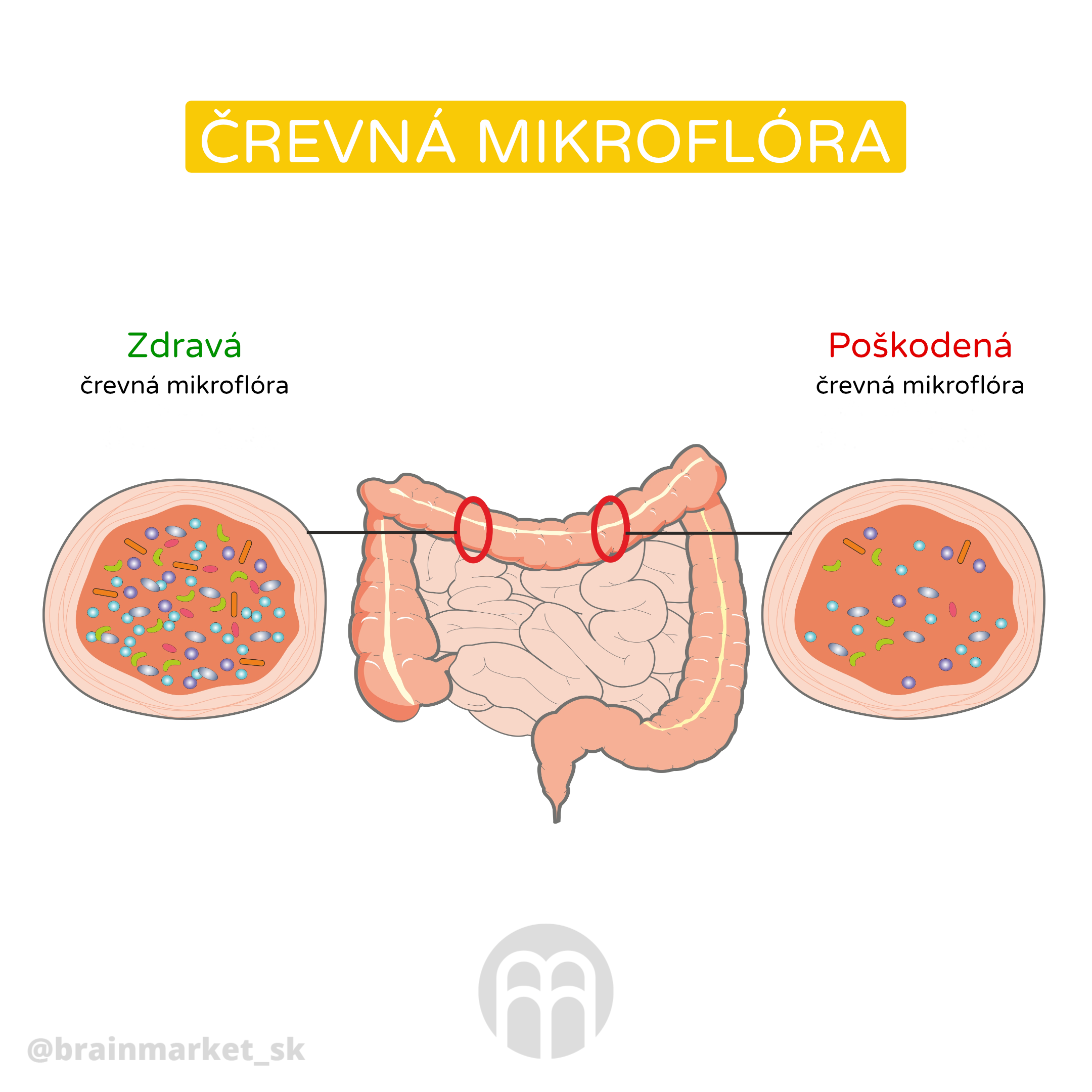 strevni mikroflora_infografika_cz